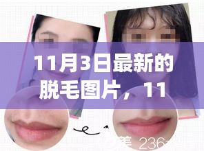 11月3日脫毛新風(fēng)尚，趣事、友情與溫暖的瞬間