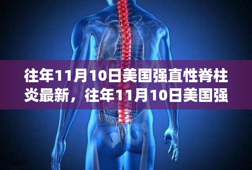 美國強直性脊柱炎最新研究進展揭秘，歷年11月10日更新動態(tài)