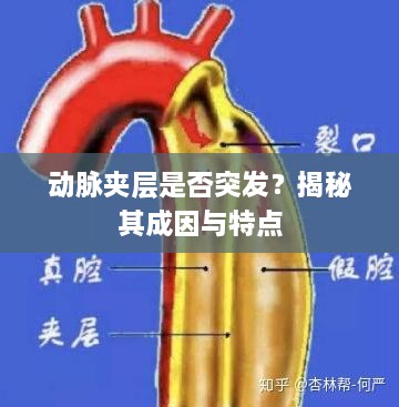 動脈夾層是否突發(fā)？揭秘其成因與特點