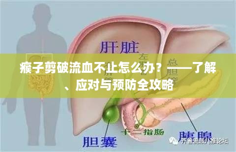 瘊子剪破流血不止怎么辦？——了解、應(yīng)對與預(yù)防全攻略