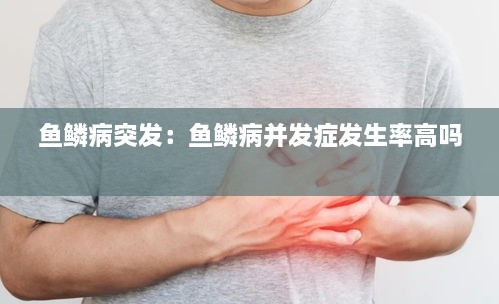 魚鱗病突發(fā)：魚鱗病并發(fā)癥發(fā)生率高嗎 