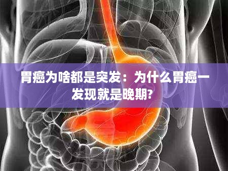 胃癌為啥都是突發(fā)：為什么胃癌一發(fā)現(xiàn)就是晚期? 
