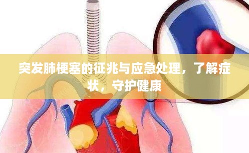 突發(fā)肺梗塞的征兆與應(yīng)急處理，了解癥狀，守護(hù)健康