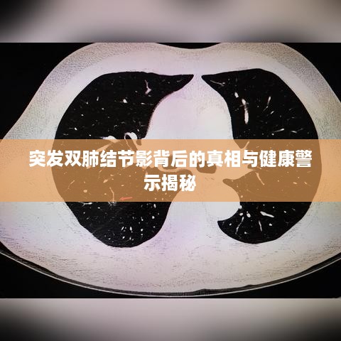 突發(fā)雙肺結(jié)節(jié)影背后的真相與健康警示揭秘