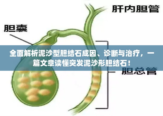全面解析泥沙型膽結(jié)石成因、診斷與治療，一篇文章讀懂突發(fā)泥沙形膽結(jié)石！