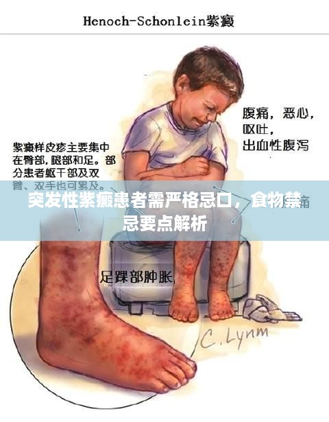 突發(fā)性紫癜患者需嚴(yán)格忌口，食物禁忌要點(diǎn)解析