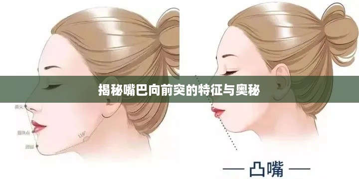 揭秘嘴巴向前突的特征與奧秘